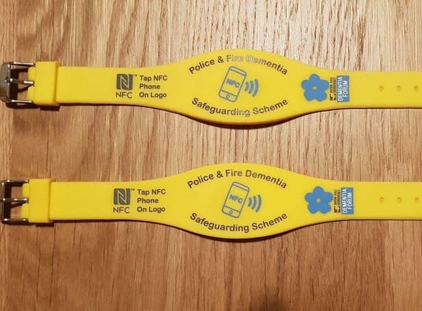 The wristbands.