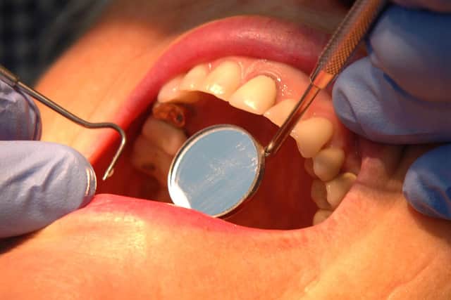 Checking condition of teeth with a visit to the dentist.