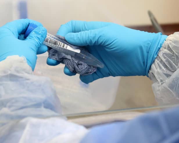 At least two deaths linked to the coronavirus in West Lindsey's care homes have occurred outside hospital, new figures suggest.