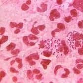 East Lindsey one of top areas with lowest number of gonorrhoea cases