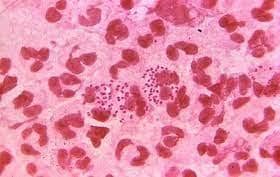 East Lindsey one of top areas with lowest number of gonorrhoea cases