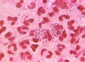 East Lindsey one of top areas with lowest number of gonorrhoea cases
