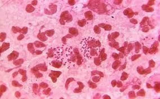 East Lindsey one of top areas with lowest number of gonorrhoea cases