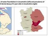 The distribution of water fluoridation in Lincolnshire.