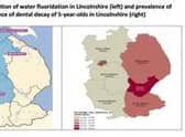 The distribution of water fluoridation in Lincolnshire.