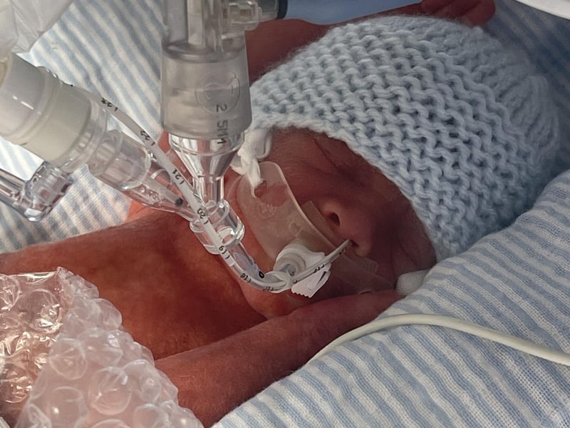 Little Luca in hospital.