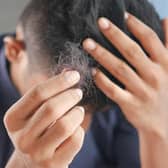 As a county, Lincolnshire is said to be the second 'least concerned' about hair loss in the UK, according to Google's search history.