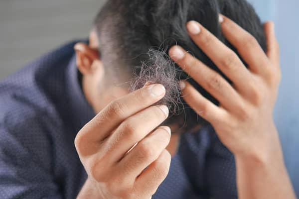 As a county, Lincolnshire is said to be the second 'least concerned' about hair loss in the UK, according to Google's search history.