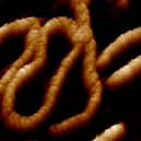 One of the 'dancing DNA' images