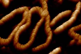 One of the 'dancing DNA' images