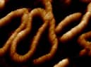 One of the 'dancing DNA' images