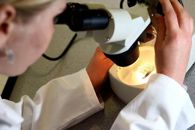 Cervical cancer could be eliminated in Britain within 30 years