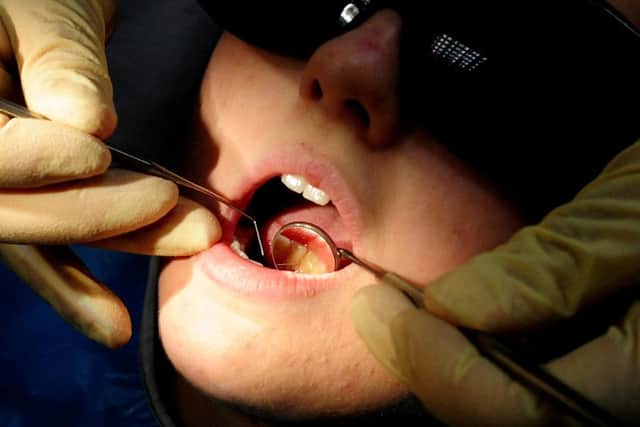 More than 60,000 children in Lincolnshire have not seen an NHS dentist in the last year