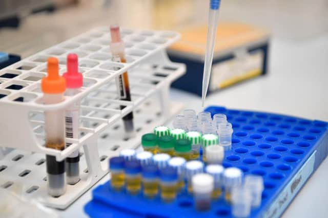 The new urine test could be just as effective as the smear test.