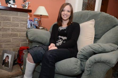 Jessica Hodge who has CRPS, a painful skin condition on her leg which has left her needing a wheelchair and awaiting an op to help control the pain G130118-1a
