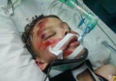 Lucas Thorpe, when he was in intensive care