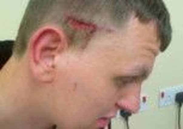 An Worksop 18-year-old sustained this horrific gash in his head after being attacked while walking home