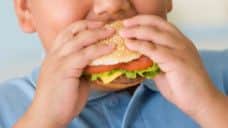 Obese child.