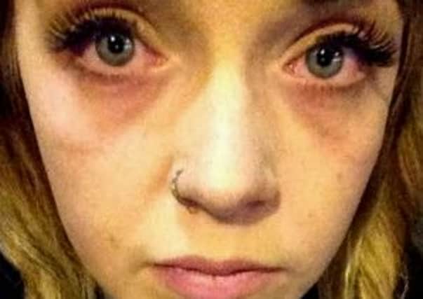 Bar maid Melissa Seaman, 21, took this photo after her eyes started burning during the gas attack