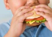 Obese child.