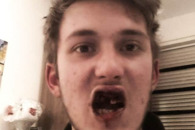 Tom Wowk took this picture shortly after the attack