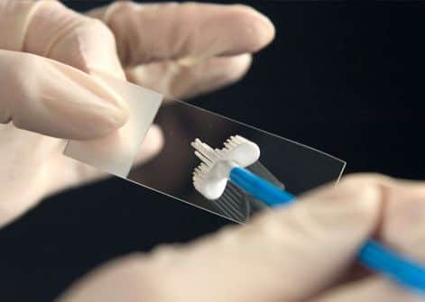 Smear test.