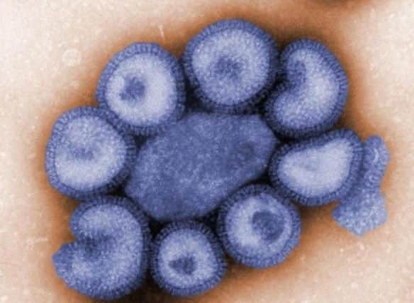 Swine flu