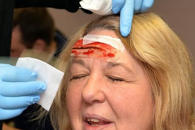 Is it an emergency? EMAS warns that pressure from unnecessary call-outs is burdening the service. (Picture: A first-aider dresses a false cut as part of St John's Ambulance training).