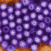 Cases of Norovirus are expected to rise
