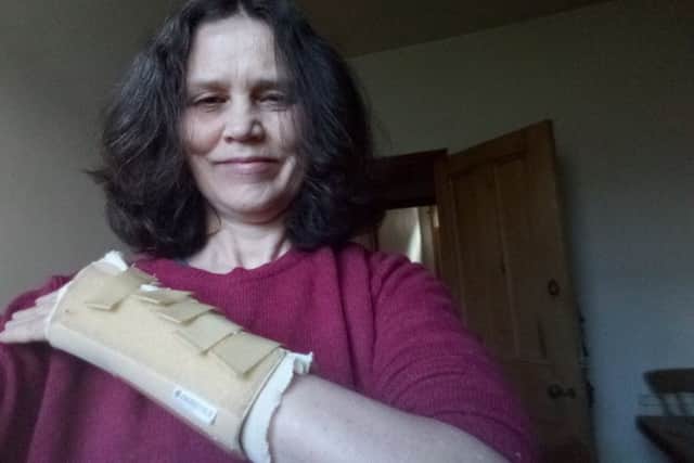 Gay Bolton with plastered wrist.