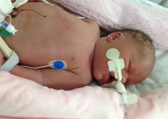 Bonnie Rose is pictured in hospital.