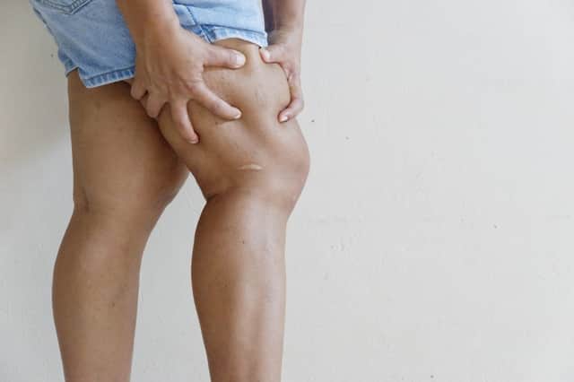 Throbbing or cramping pain, swelling, redness and warmth in a leg or arm is the main symptom of a blood clot (Photo: Shutterstock)