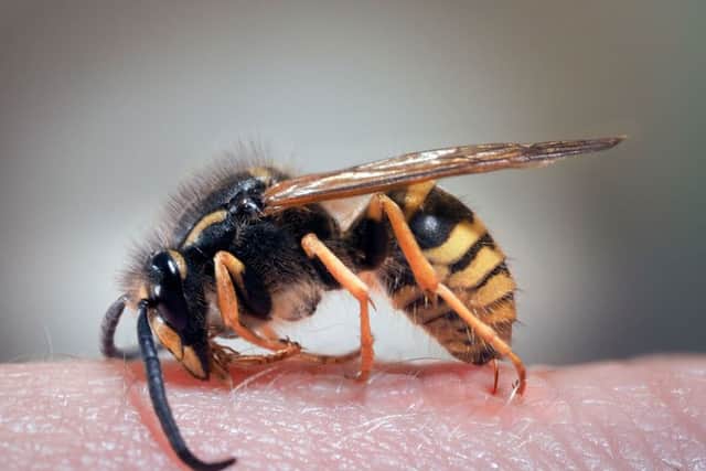 Wasp stings