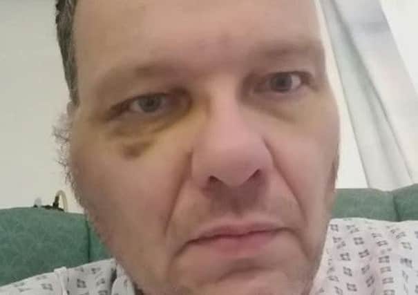 Nigel recovering in hospital in 2015.