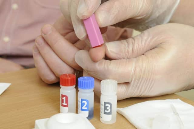 HIV testing (stock image).