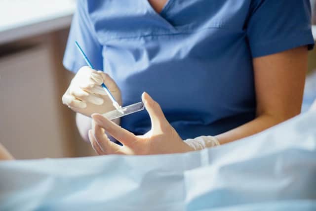 Smear test