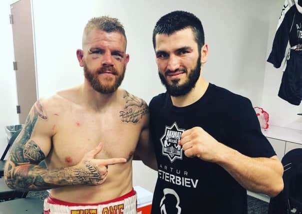 Callum Johnson after his bout with Beterbiev.