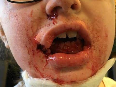 Kiera after the attack