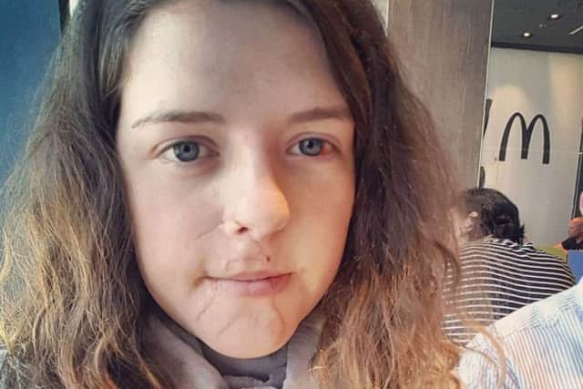 Beth Searby pictured 10 days after her crash. EMN-190528-100003001