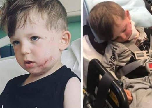 Oscar pictured (left) in hospital, and (right) in the ambulance after being bitten. EMN-190306-194648001