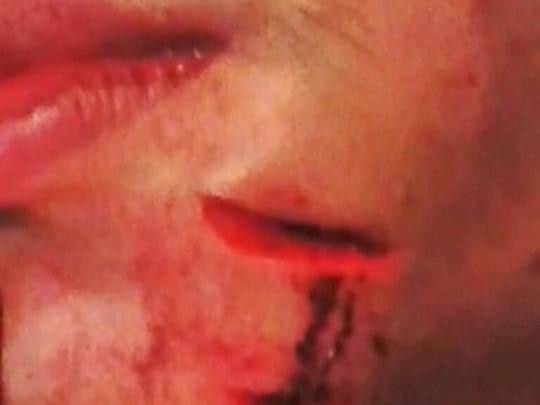 It is expected the wound will need 60 stitches.