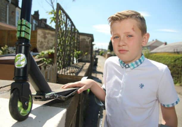 McKenzie Sumner (11) who is lucky to escape serious injury after being hit by a car while riding his scooter?