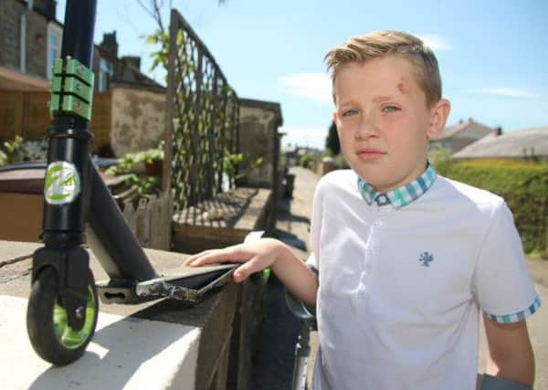 McKenzie Sumner (11) who is lucky to escape serious injury after being hit by a car while riding his scooter?