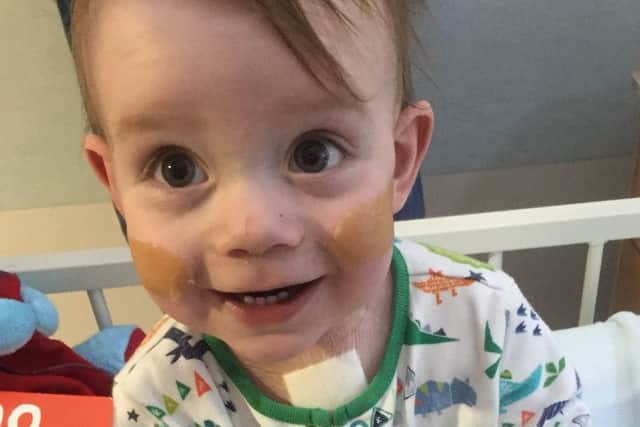 Little Elijah Rose after his heart operation, just two weeks before his first birthday. EMN-160902-093424001