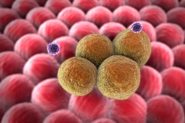 Cancer cells