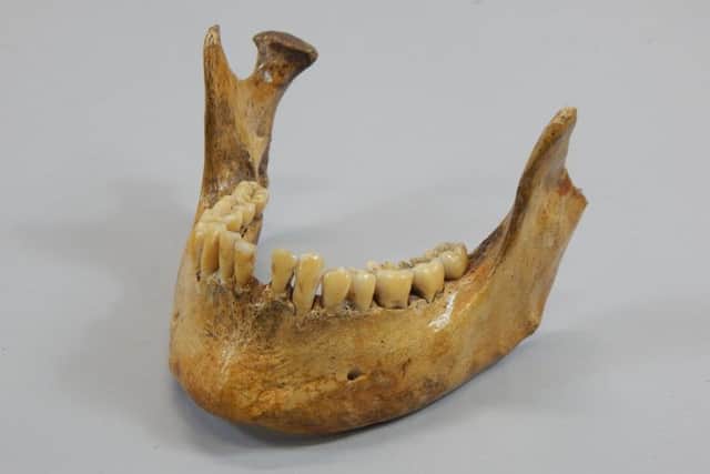 The jaw bone discovered in Sleaford to be autioned off. EMN-160310-174112001
