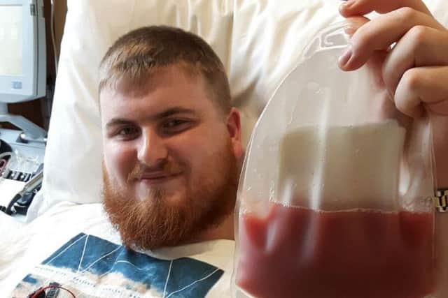 Jack Sherlock holding the donation of stem cells EMN-170405-170641001
