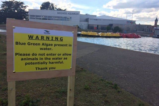 One of the warning signs around Skegness Boating Lake. ANL-170307-181529001